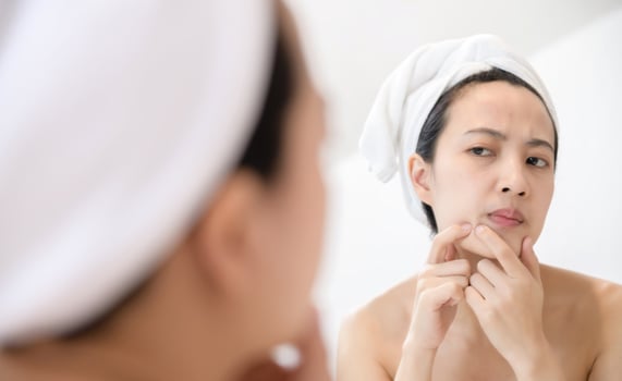 Problem skin. Concerned young asian women popping pimple on cheek while standing near mirror in bathroom. young asian women with acne photo