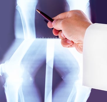 Doctor studying x-rays of the hand of the two knees photo