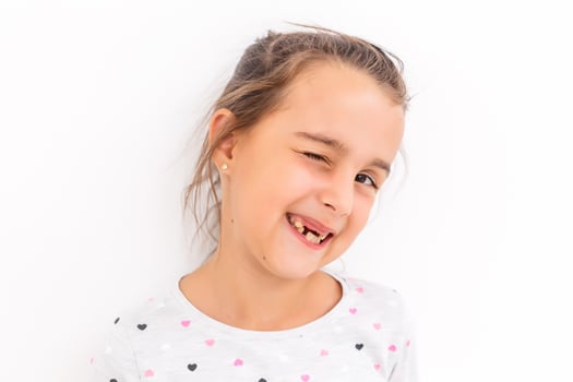 Little girl first tooth missing photo