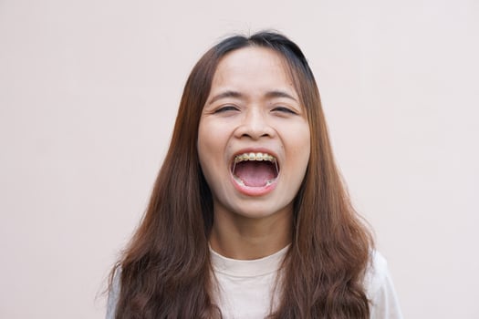Asian women with disorganized braces photo