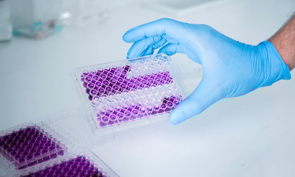cell culture at the medicine, medical and cell culture laboratory photo