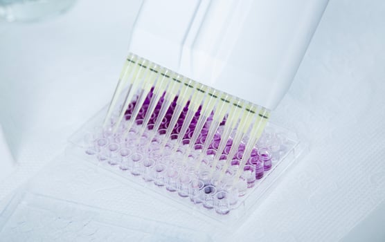 cell culture at the medicine, medical and cell culture laboratory photo