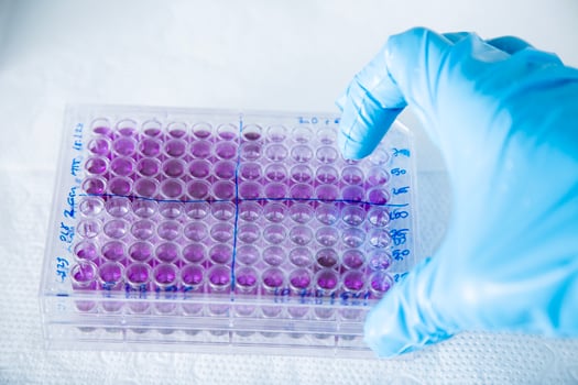 cell culture at the medicine, medical and cell culture laboratory photo