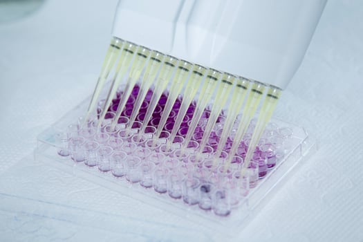 cell culture at the medicine, medical and cell culture laboratory photo