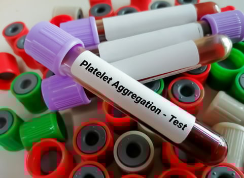 Blood sample for platelet aggregation test photo