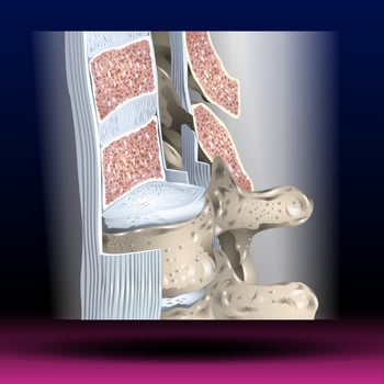 Anterior Longitudinal Ligament - Body Parts - Spine photo