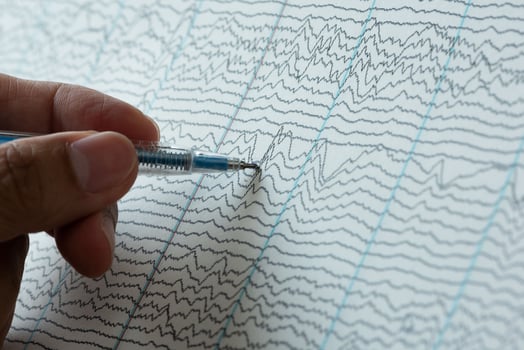 Doctor pointing at abnormal brain waves photo