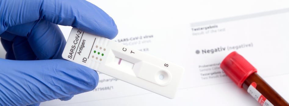 Negative test result by using rapid test device for COVID-19. photo