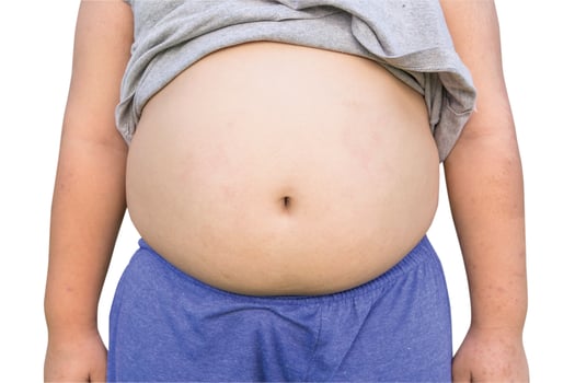 Boy fat and Unhealthy on isolated white with clipping path. photo