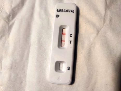 Covid rapid test kit positive result photo