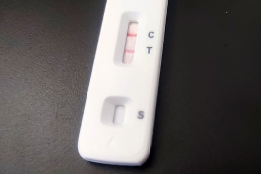 Covid rapid test kit positive result photo