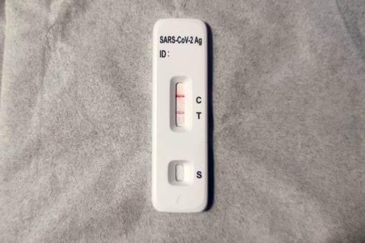 Covid rapid test kit positive result photo