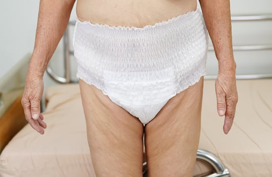 Asian elder senior woman patient wearing adult incontinence diaper pad in hospital. photo