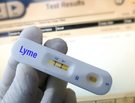 Rapid test cassette for Lyme disease testing. photo