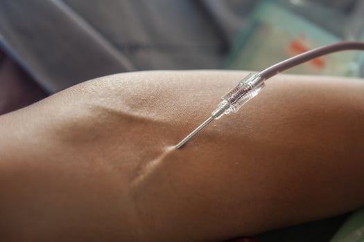 Volunteer to donate blood to help fellow human beings. photo