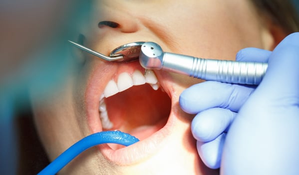 Woman getting a dental treatment photo
