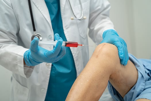 Asian elderly woman patient show her scars surgical total knee joint replacement Suture wound surgery arthroplasty in hospital, healthy strong medical concept. photo