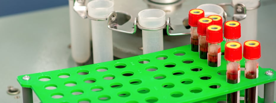 Test tubes with blood samples photo