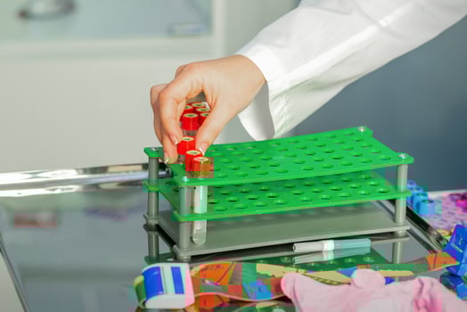 Technician puts test tube to rack photo