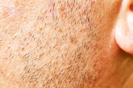 male stubble close. unshaven male cheek. unshaven face of a man photo