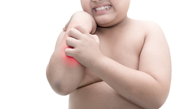 obese fat boy scratch the itch with hand. itching isolated on white background, photo