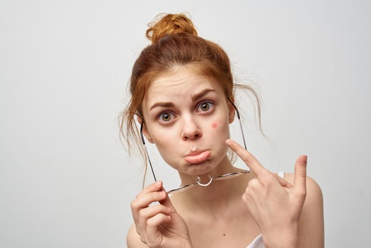 woman in a white t-shirt with glasses pimples on her face photo