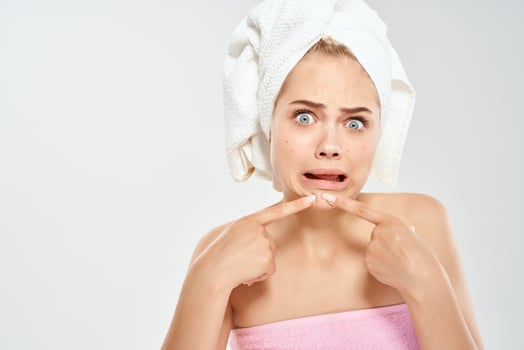 woman with bare shoulders facial skin care acne dermatology close-up photo