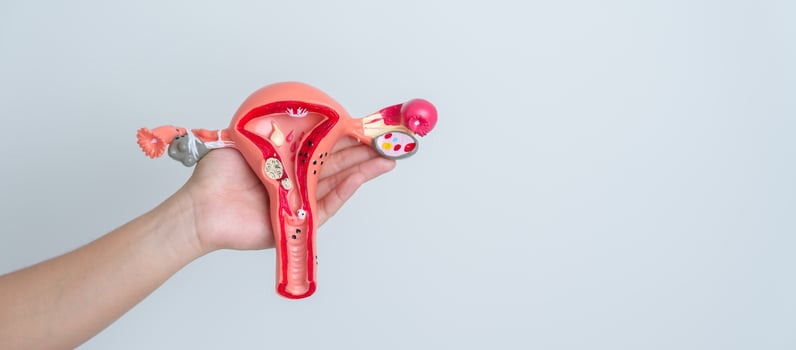Woman holding Uterus and Ovaries model. Ovarian and Cervical cancer, Cervix disorder, Endometriosis, Hysterectomy, Uterine fibroids, Reproductive system and Pregnancy concept photo