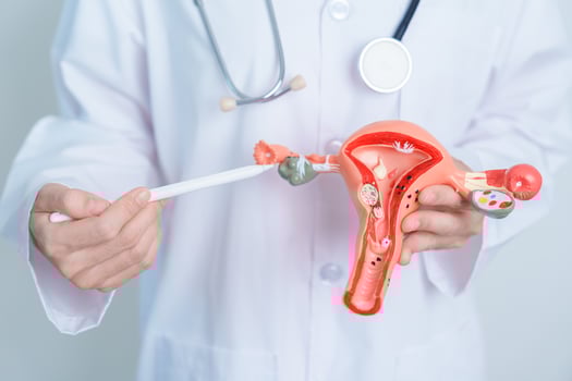 Doctor holding Uterus and Ovaries model. Ovarian and Cervical cancer, Cervix disorder, Endometriosis, Hysterectomy, Uterine fibroids, Reproductive system and Pregnancy concept photo