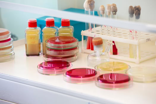 Bacterial colonies of streptococci with alpha hemolytics on a blood agar plate. Infection laboratory at the hospital. photo
