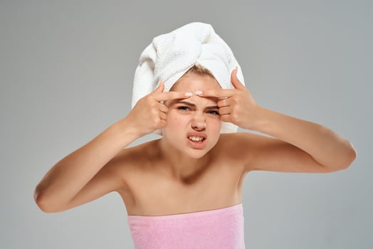 pretty woman with bare shoulders squeeze pimples on her face skin problems photo