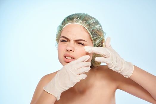 woman with bare shoulders squeeze pimples on her face dermatology photo
