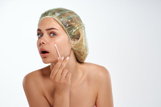 woman with bare shoulders wipes her face with a cotton swab skin problems photo