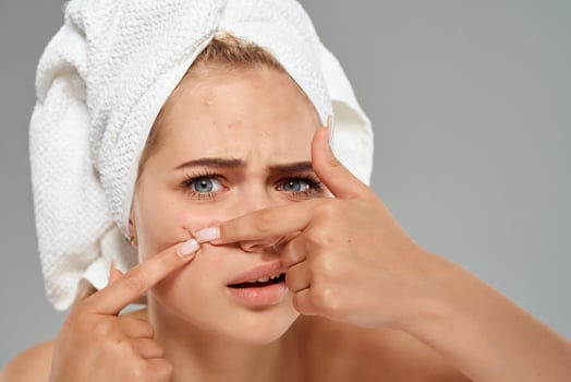 pretty woman with bare shoulders squeeze pimples on her face skin problems photo