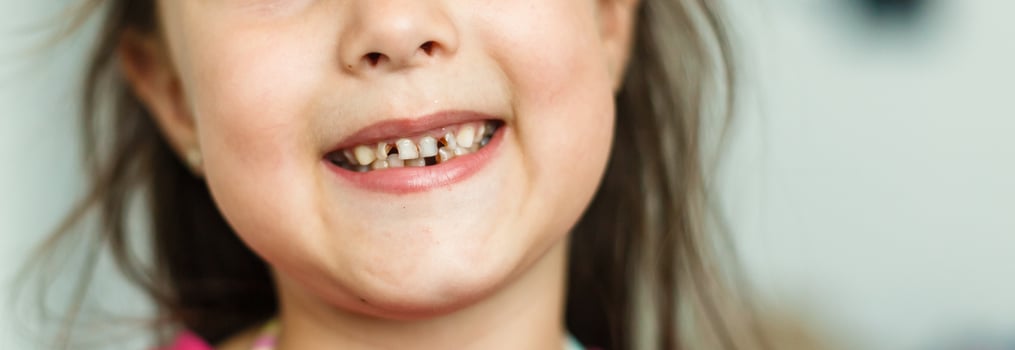 Little girl fell a baby tooth. Child's mouth with hole between the teeth. Shallow dept of field photo