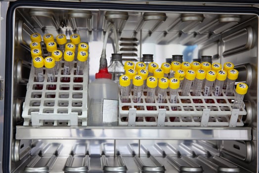 Test tubes with blood samples in the incubator during the process of preparation for karyotype and fluorescence in situ hybridization - FISH in the laboratory photo