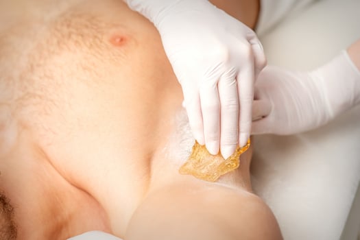Young caucasian man receiving hair removal from his armpit in a beauty salon, depilation men's underarm. photo
