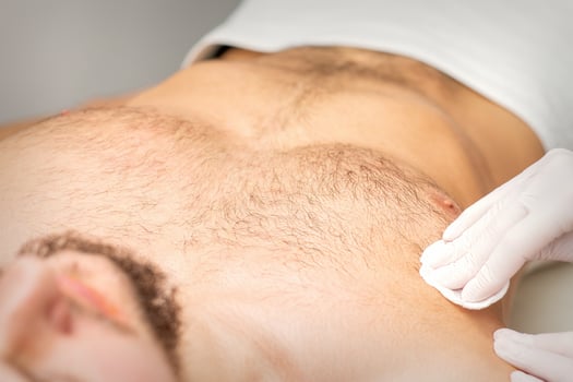 Young caucasian man receiving hair removal from his chest in a beauty salon, depilation men's torso. photo