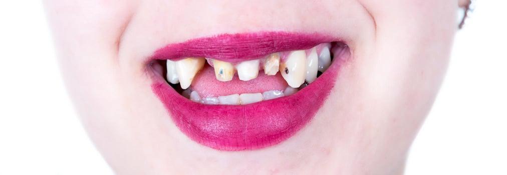 Female smile with no teeth photo
