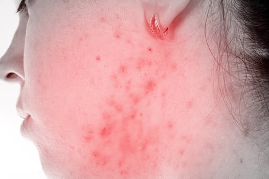 Problems with skin photo