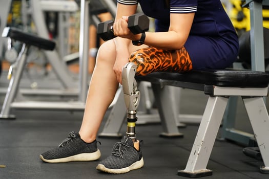 Young female with one prosthetic leg warms up by lifting light weights. Concept of living a woman's life with a prosthetic limb. photo