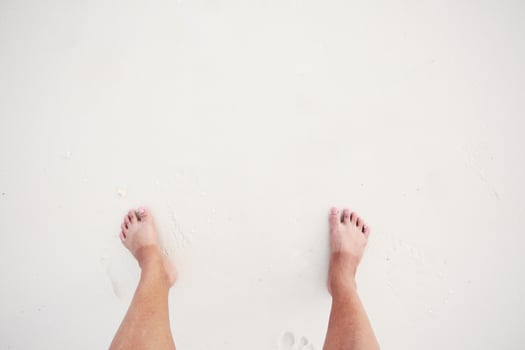 Asian woman have Two-color foot skin with sun-bath on white beach and sea photo