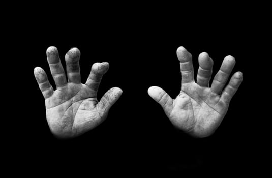 Deformed hands of a farmer photo