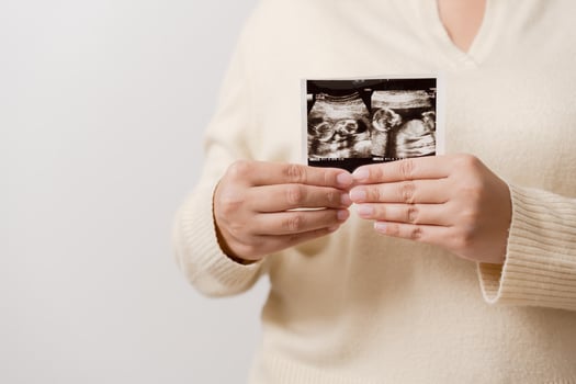 Pregnant woman holding ultrasound film of her baby. Happy mother and newborn baby in process. Love of parents to infant in few months before give birth. photo