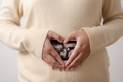 Pregnant woman holding ultrasound film of her baby. Happy mother and newborn baby in process. Love of parents to infant in few months before give birth. photo