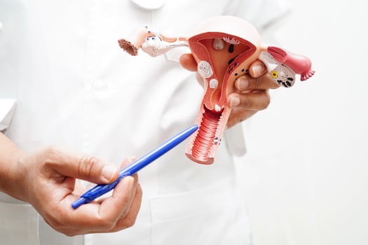 Uterus, doctor holding anatomy model for study diagnosis and treatment in hospital. photo
