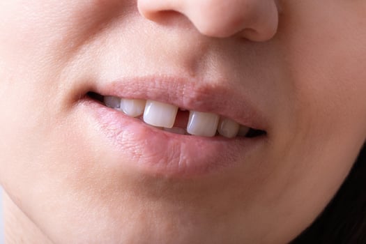 Close up of woman's open smiling mouth with gap teeht. Lips and unusual teeth photo