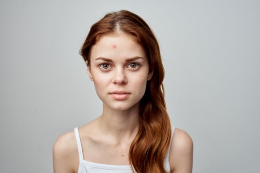 woman with a pimple on the face cosmetology Studio photo