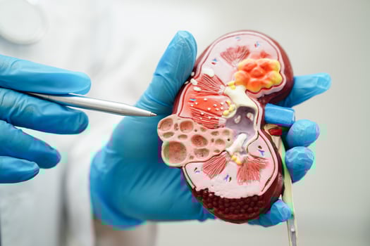 Chronic kidney disease, doctor holding model for treatment urinary system, urology, Estimated glomerular filtration rate eGFR. photo