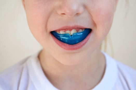 Dental simulator for teeth alignment . The child has mouth guards on his teeth. photo